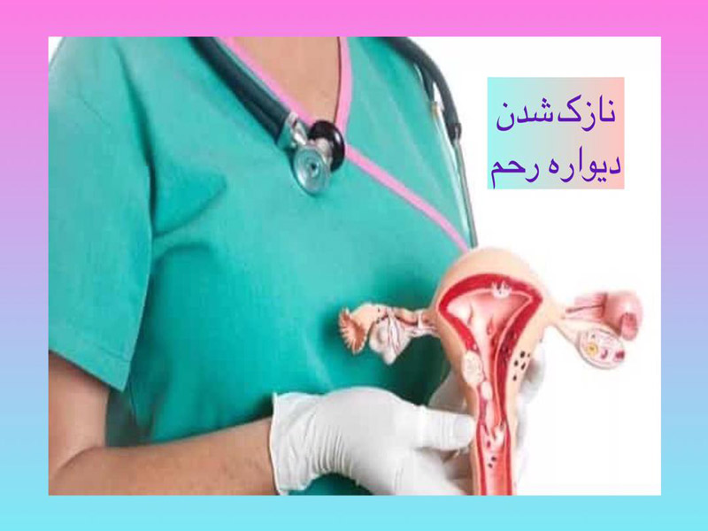نازک شدن دیواره رحم