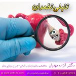 تنبلی-تخمدان