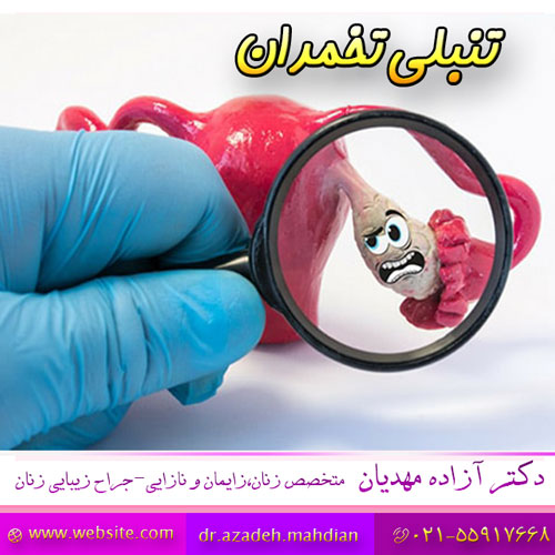 تنبلی-تخمدان