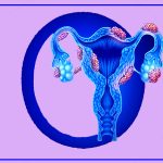 اندومتریوز