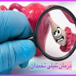 درمان تنبلی تخمدان
