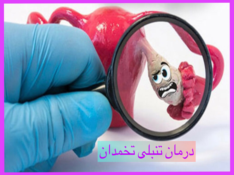درمان تنبلی تخمدان