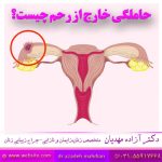 حاملگی خارج از رحم چیست؟