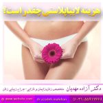 هزینه لابیاپلاستی چقدر است؟