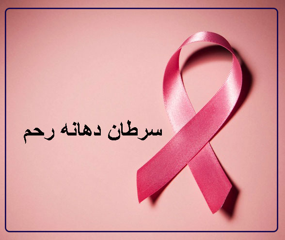 سرطان دهانه رحم