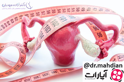 سایز تخمدان بزرگ