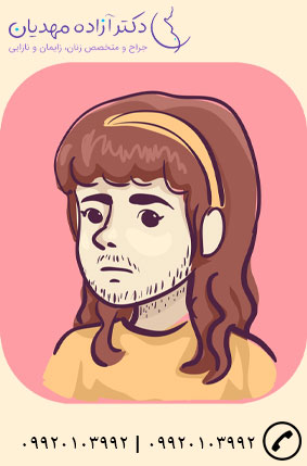 موی زائید در تشخیص تنبلی تخمدان