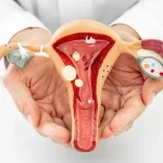 جراحی پرینورافی؛ از مراحل جراحی تا ماندگاری آن