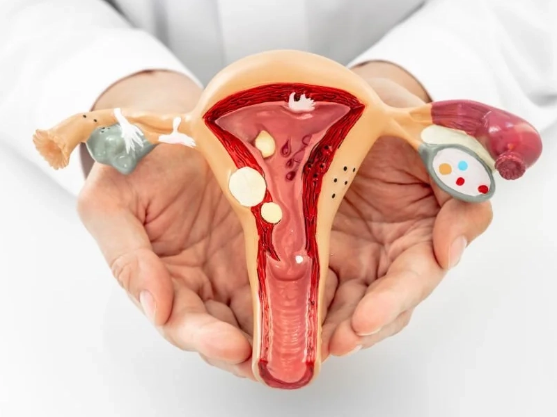 جراحی پرینورافی؛ از مراحل جراحی تا ماندگاری آن