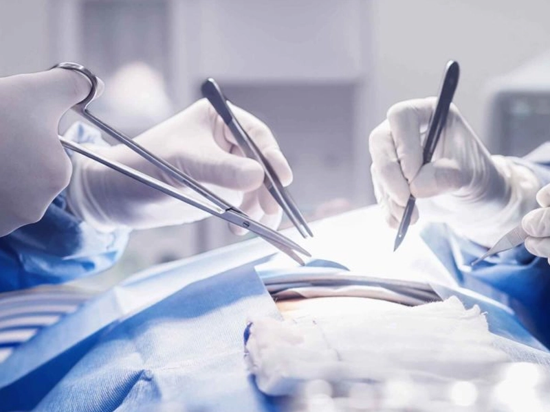 جراحی ترمیم لابیاپلاستی برای اصلاح نتایج نامطلوب