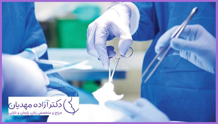 دوران نقاهت لابیاپلاستی ترمیمی چقدر طول می‌کشد؟