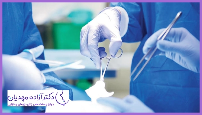 مراحل انجام جراحی لابیاپلاستی